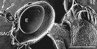 Lateral head and scutum of Pristaulacus mouldsi, female, from Western Australia.