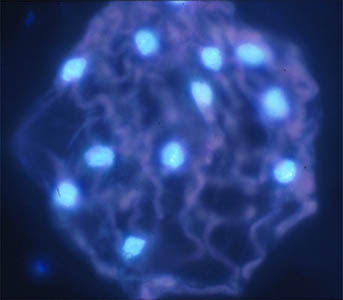 DAPI stained cell showing multiple brightly fluorescing nuclei